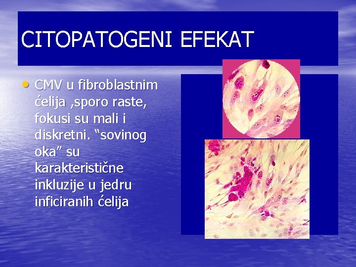 CITOPATOGENI EFEKAT • CMV u fibroblastnim ćelija , sporo raste, fokusi su mali i CITOPATOGENI EFEKAT • CMV u fibroblastnim ćelija , sporo raste, fokusi su mali i