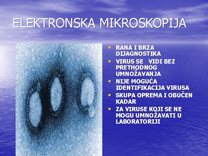 ELEKTRONSKA MIKROSKOPIJA • RANA I BRZA • • DIJAGNOSTIKA VIRUS SE VIDI BEZ PRETHODNOG ELEKTRONSKA MIKROSKOPIJA • RANA I BRZA • • DIJAGNOSTIKA VIRUS SE VIDI BEZ PRETHODNOG