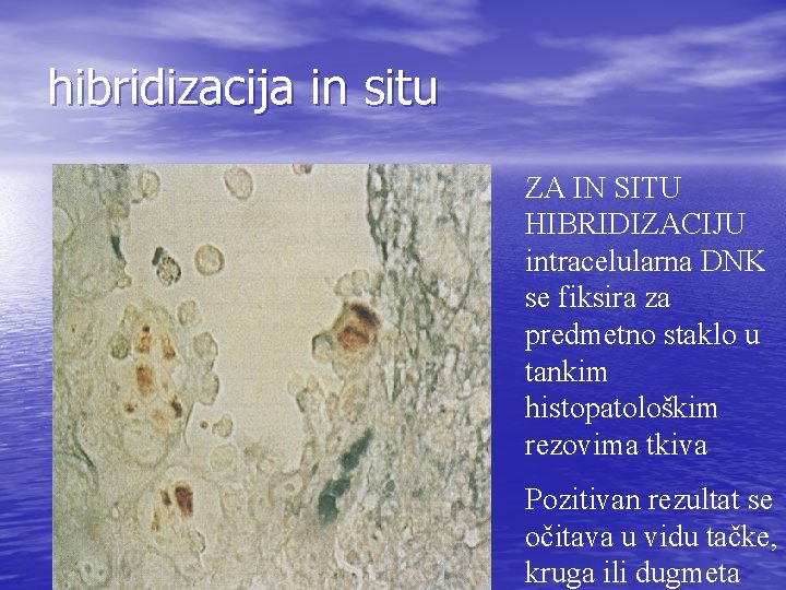 hibridizacija in situ ZA IN SITU HIBRIDIZACIJU intracelularna DNK se fiksira za predmetno staklo hibridizacija in situ ZA IN SITU HIBRIDIZACIJU intracelularna DNK se fiksira za predmetno staklo