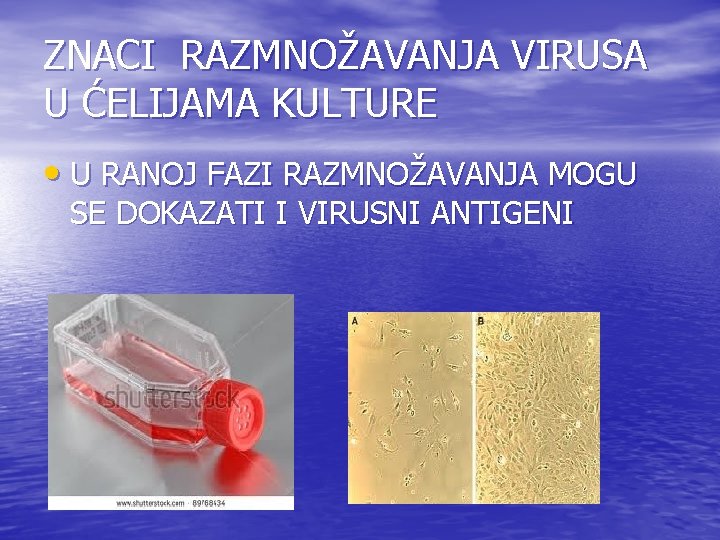 ZNACI RAZMNOŽAVANJA VIRUSA U ĆELIJAMA KULTURE • U RANOJ FAZI RAZMNOŽAVANJA MOGU SE DOKAZATI ZNACI RAZMNOŽAVANJA VIRUSA U ĆELIJAMA KULTURE • U RANOJ FAZI RAZMNOŽAVANJA MOGU SE DOKAZATI