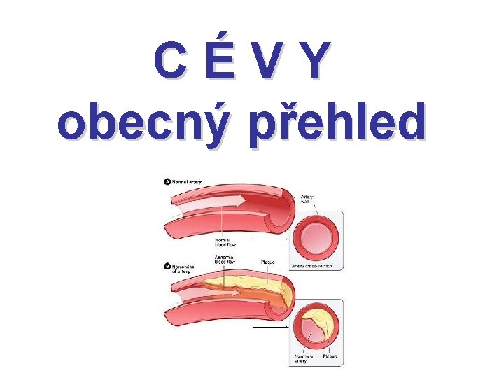 C É V Y obecný přehled 