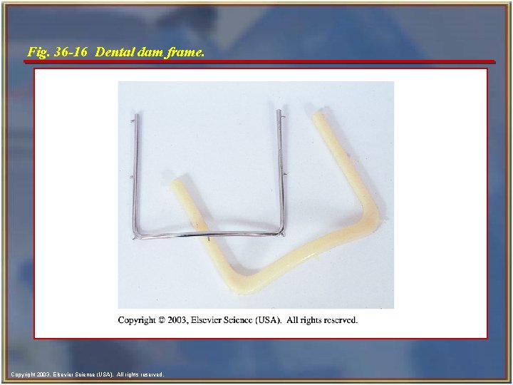 Fig. 36 -16 Dental dam frame. Copyright 2003, Elsevier Science (USA). All rights reserved.