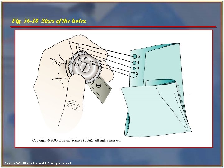 Fig. 36 -18 Sizes of the holes. Copyright 2003, Elsevier Science (USA). All rights