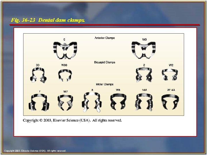 Fig. 36 -23 Dental dam clamps. Copyright 2003, Elsevier Science (USA). All rights reserved.