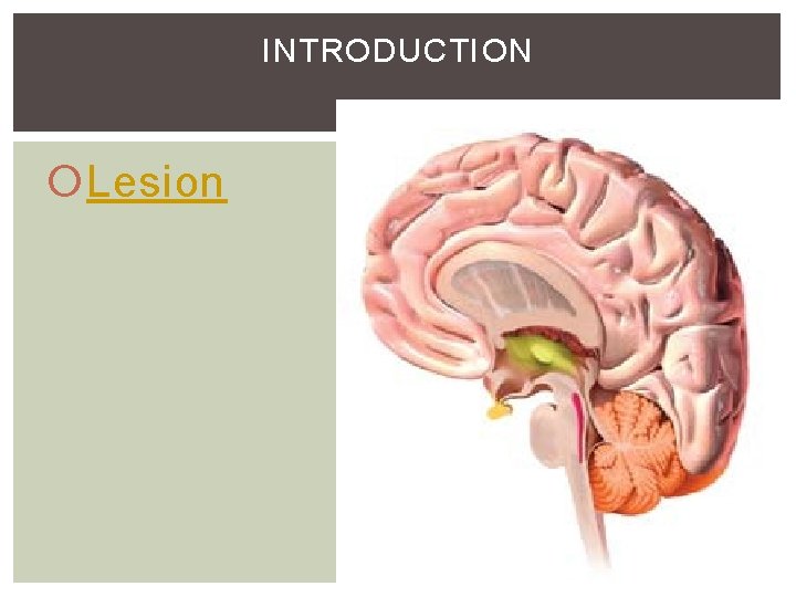 INTRODUCTION Lesion INTRODUCTION Lesion