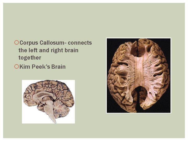 Corpus Callosum- connects the left and right brain together Kim Peek’s Brain Corpus Callosum- connects the left and right brain together Kim Peek’s Brain