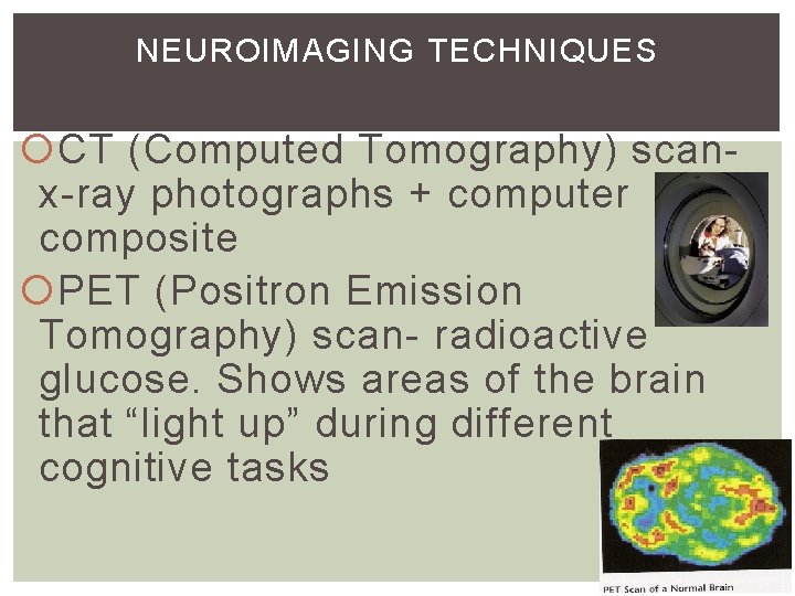 NEUROIMAGING TECHNIQUES CT (Computed Tomography) scanx-ray photographs + computer composite PET (Positron Emission Tomography) NEUROIMAGING TECHNIQUES CT (Computed Tomography) scanx-ray photographs + computer composite PET (Positron Emission Tomography)
