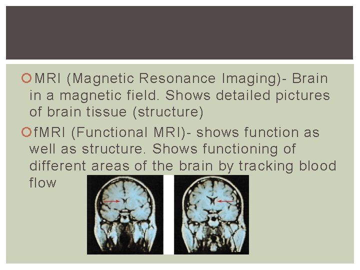 MRI (Magnetic Resonance Imaging)- Brain in a magnetic field. Shows detailed pictures of MRI (Magnetic Resonance Imaging)- Brain in a magnetic field. Shows detailed pictures of