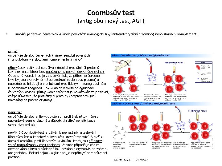 Coombsův test (antiglobulinový test, AGT) • umožňuje detekci červených krvinek, pokrytých imunoglobuliny (antierytrocytární protilátky)