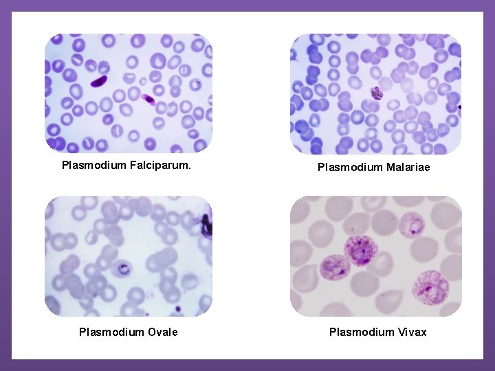 Plasmodium Falciparum. Plasmodium Ovale Plasmodium Malariae Plasmodium Vivax 