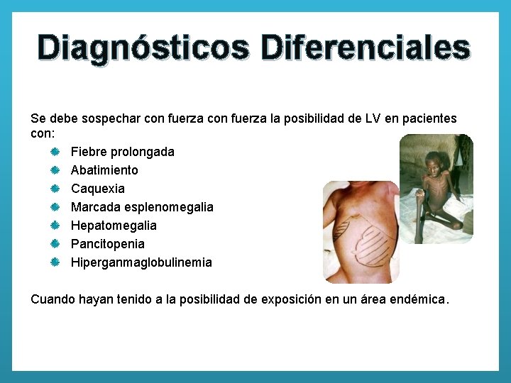 Diagnósticos Diferenciales Se debe sospechar con fuerza la posibilidad de LV en pacientes con: