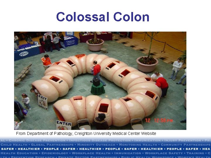 Colossal Colon From Department of Pathology, Creighton University Medical Center Website Colossal Colon From Department of Pathology, Creighton University Medical Center Website