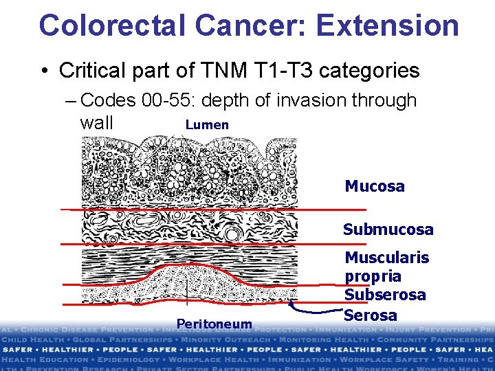 Colorectal Cancer: Extension • Critical part of TNM T 1 -T 3 categories – Colorectal Cancer: Extension • Critical part of TNM T 1 -T 3 categories –