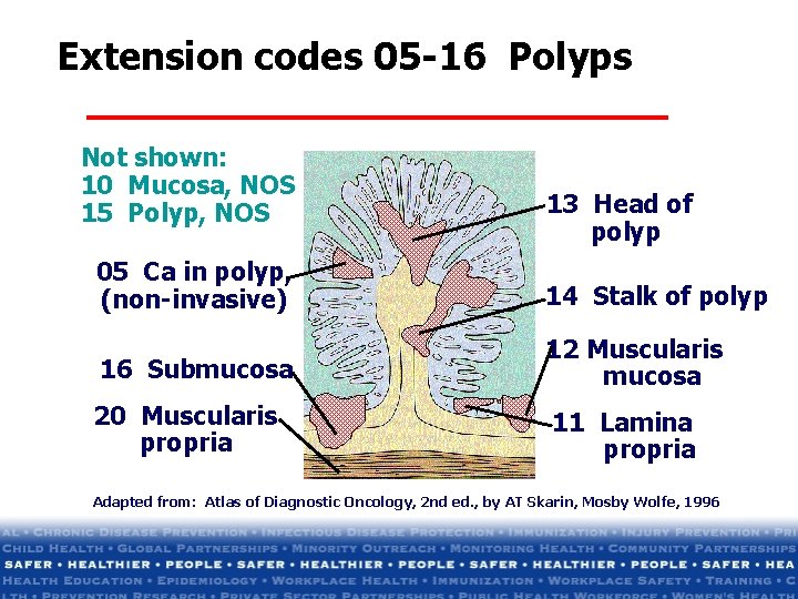 Extension codes 05 -16 Polyps Not shown: 10 Mucosa, NOS 15 Polyp, NOS 13 Extension codes 05 -16 Polyps Not shown: 10 Mucosa, NOS 15 Polyp, NOS 13
