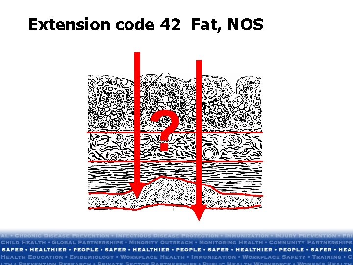 Extension code 42 Fat, NOS ? Extension code 42 Fat, NOS ?