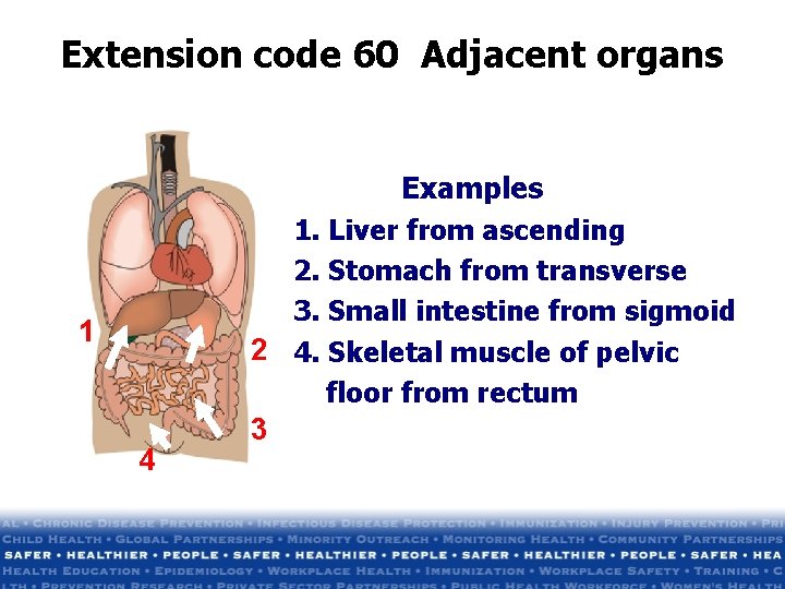 Extension code 60 Adjacent organs 1 4 Examples 1. Liver from ascending 2. Stomach Extension code 60 Adjacent organs 1 4 Examples 1. Liver from ascending 2. Stomach