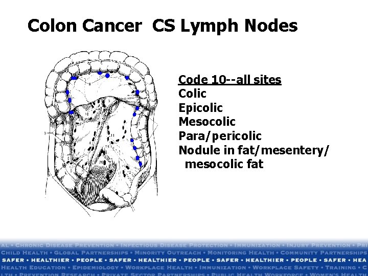 Colon Cancer CS Lymph Nodes Code 10 --all sites Colic Epicolic Mesocolic Para/pericolic Nodule Colon Cancer CS Lymph Nodes Code 10 --all sites Colic Epicolic Mesocolic Para/pericolic Nodule