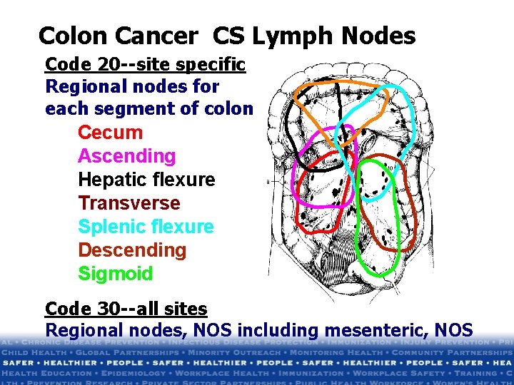Colon Cancer CS Lymph Nodes Code 20 --site specific Regional nodes for each segment Colon Cancer CS Lymph Nodes Code 20 --site specific Regional nodes for each segment