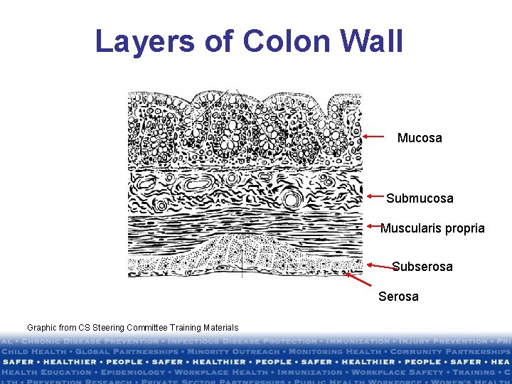 Layers of Colon Wall Mucosa Submucosa Muscularis propria Subserosa Serosa Graphic from CS Steering Layers of Colon Wall Mucosa Submucosa Muscularis propria Subserosa Serosa Graphic from CS Steering