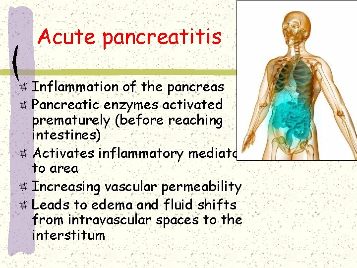 Acute pancreatitis Inflammation of the pancreas Pancreatic enzymes activated prematurely (before reaching intestines) Activates Acute pancreatitis Inflammation of the pancreas Pancreatic enzymes activated prematurely (before reaching intestines) Activates