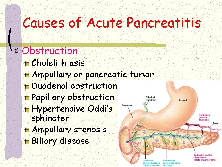 Causes of Acute Pancreatitis Obstruction Cholelithiasis Ampullary or pancreatic tumor Duodenal obstruction Papillary obstruction Causes of Acute Pancreatitis Obstruction Cholelithiasis Ampullary or pancreatic tumor Duodenal obstruction Papillary obstruction