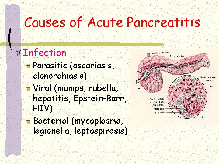 Causes of Acute Pancreatitis Infection Parasitic (ascariasis, clonorchiasis) Viral (mumps, rubella, hepatitis, Epstein-Barr, HIV) Causes of Acute Pancreatitis Infection Parasitic (ascariasis, clonorchiasis) Viral (mumps, rubella, hepatitis, Epstein-Barr, HIV)