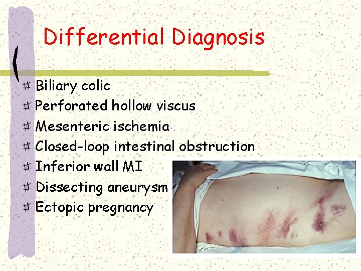 Differential Diagnosis Biliary colic Perforated hollow viscus Mesenteric ischemia Closed-loop intestinal obstruction Inferior wall Differential Diagnosis Biliary colic Perforated hollow viscus Mesenteric ischemia Closed-loop intestinal obstruction Inferior wall