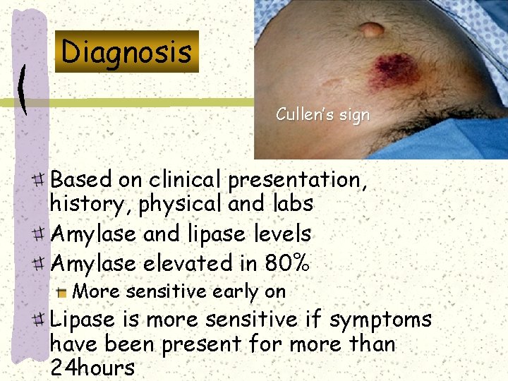 Diagnosis Cullen’s sign Based on clinical presentation, history, physical and labs Amylase and lipase Diagnosis Cullen’s sign Based on clinical presentation, history, physical and labs Amylase and lipase