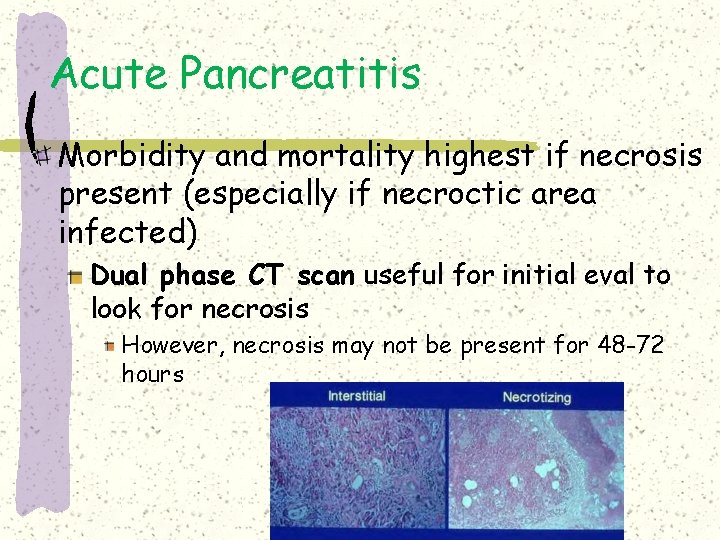 Acute Pancreatitis Morbidity and mortality highest if necrosis present (especially if necroctic area infected) Acute Pancreatitis Morbidity and mortality highest if necrosis present (especially if necroctic area infected)