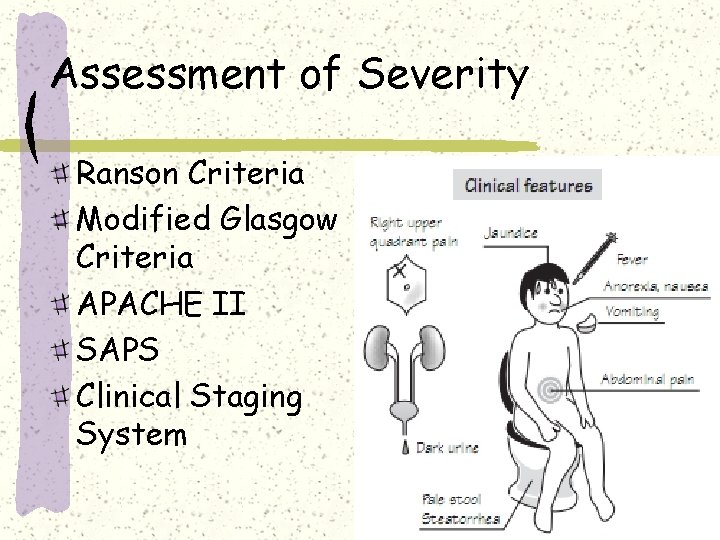 Assessment of Severity Ranson Criteria Modified Glasgow Criteria APACHE II SAPS Clinical Staging System Assessment of Severity Ranson Criteria Modified Glasgow Criteria APACHE II SAPS Clinical Staging System