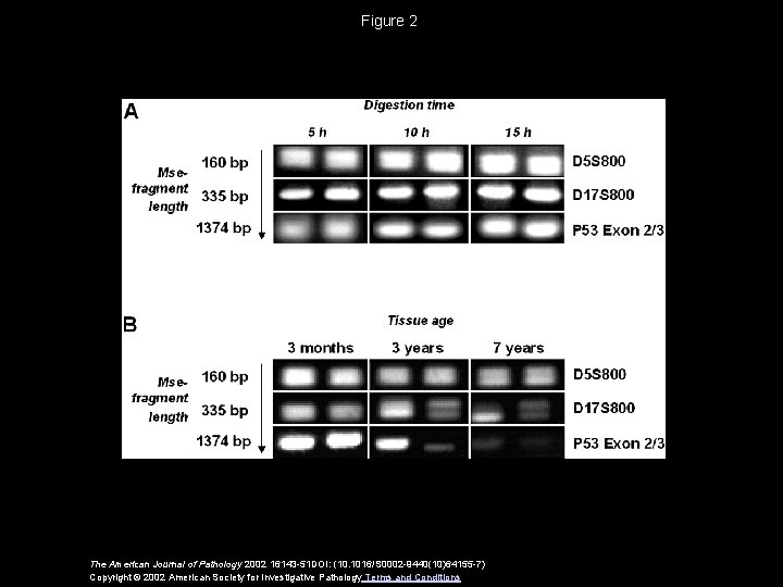 Figure 2 The American Journal of Pathology 2002 16143 -51 DOI: (10. 1016/S 0002