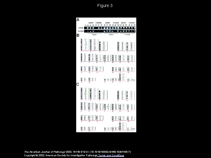 Figure 3 The American Journal of Pathology 2002 16143 -51 DOI: (10. 1016/S 0002