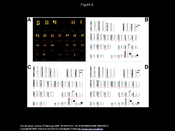 Figure 6 The American Journal of Pathology 2002 16143 -51 DOI: (10. 1016/S 0002