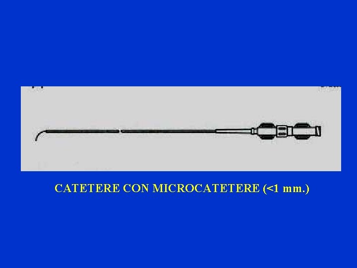 CATETERE CON MICROCATETERE (<1 mm. ) 