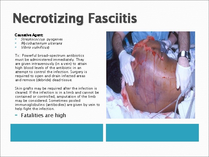 Necrotizing Fasciitis Causative Agent: Streptococcus pyogenes Mycobacterium ulcerans Vibrio vulnificus) Tx: Powerful broad-spectrum antibiotics