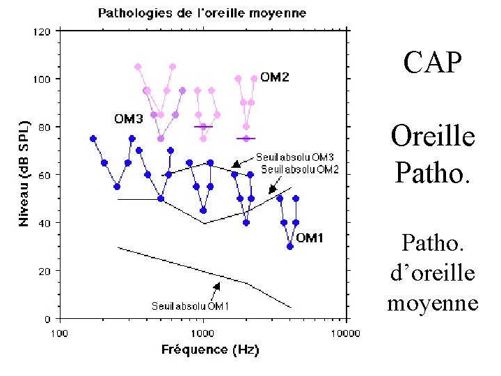 CAP Oreille Patho. d’oreille moyenne 