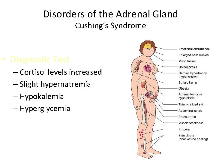 Disorders of the Adrenal Gland Cushing’s Syndrome • Diagnostic Test – Cortisol levels increased