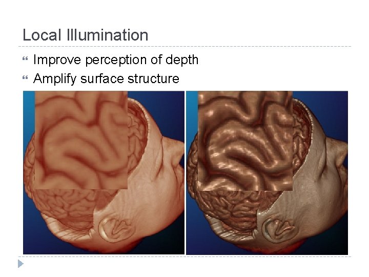 Local Illumination Improve perception of depth Amplify surface structure 