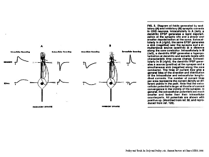 Pedley and Traub. In: Daly and Pedley, eds. Current Practice of Clinical EEG, 1990 Pedley and Traub. In: Daly and Pedley, eds. Current Practice of Clinical EEG, 1990
