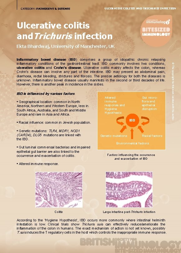 CATEGORY: PATHOGENS & DISEASE ULCERATIVE COLITIS AND TRICHURIS INFECTION Ulcerative colitis and. Trichuris infection