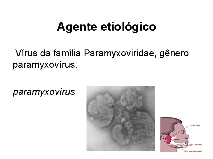 Agente etiológico Vírus da família Paramyxoviridae, gênero paramyxovírus 