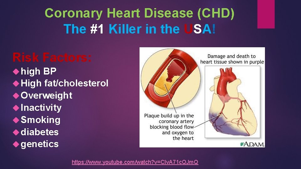 Coronary Heart Disease (CHD) The #1 Killer in the USA! Risk Factors: high BP