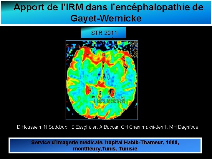 Apport de l’IRM dans l’encéphalopathie de Gayet-Wernicke STR 2011 © D Houssein, N Saddoud,