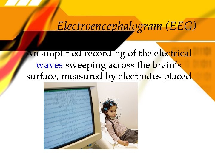 Electroencephalogram (EEG) An amplified recording of the electrical waves sweeping across the brain’s surface,
