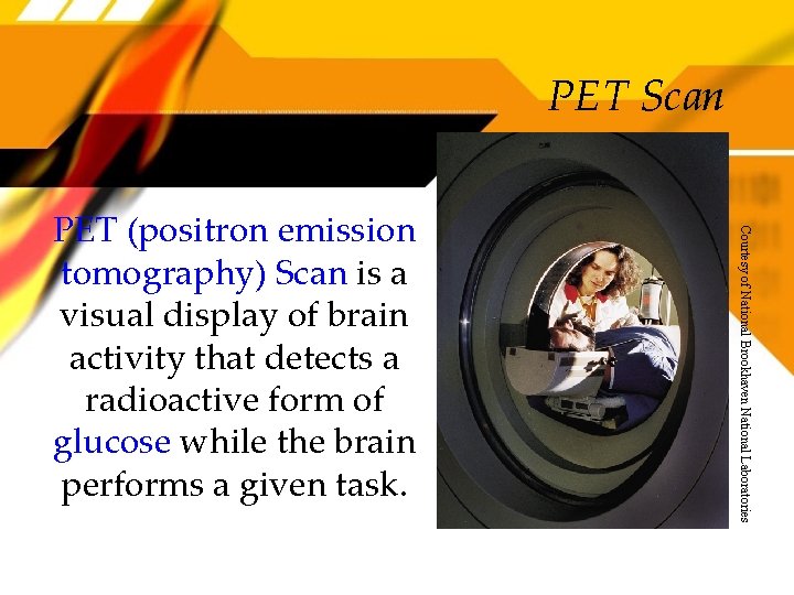 PET Scan Courtesy of National Brookhaven National Laboratories PET (positron emission tomography) Scan is