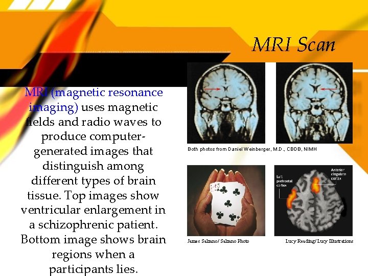MRI Scan MRI (magnetic resonance imaging) uses magnetic fields and radio waves to produce
