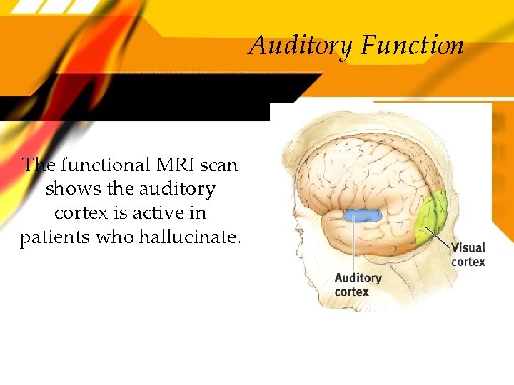 Auditory Function The functional MRI scan shows the auditory cortex is active in patients