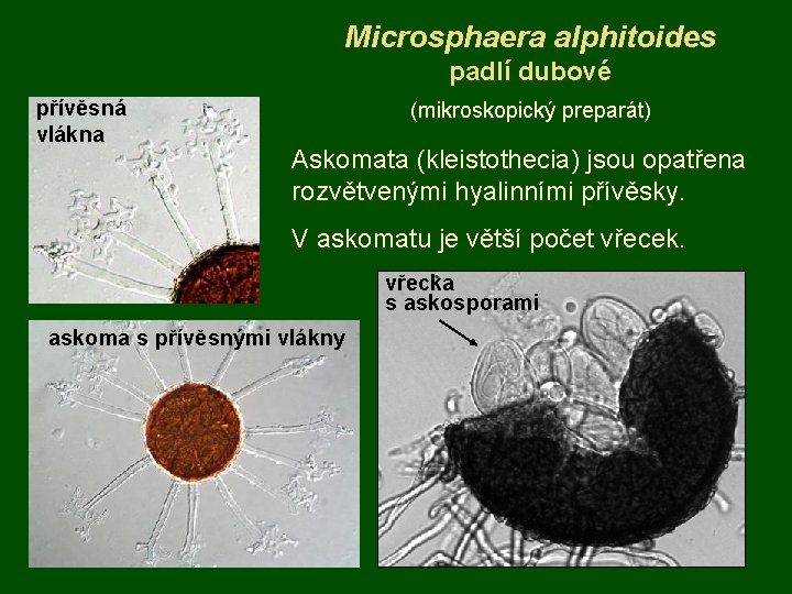 Microsphaera alphitoides padlí dubové přívěsná vlákna (mikroskopický preparát) Askomata (kleistothecia) jsou opatřena rozvětvenými hyalinními