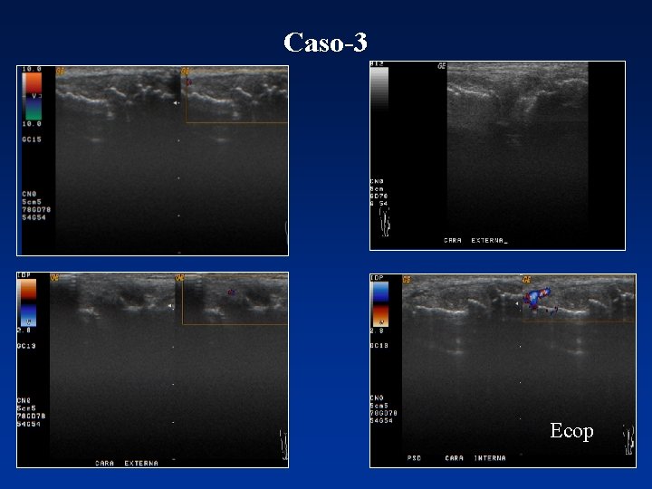 Caso-3 Ecop 