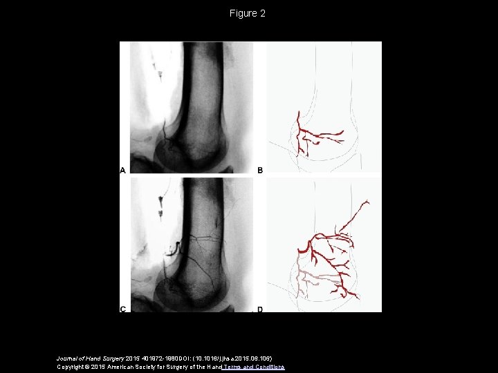 Figure 2 Journal of Hand Surgery 2015 401972 -1980 DOI: (10. 1016/j. jhsa. 2015.